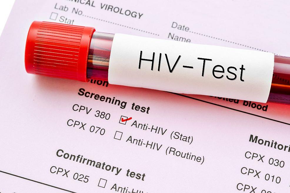 Тестове за ХИВ
