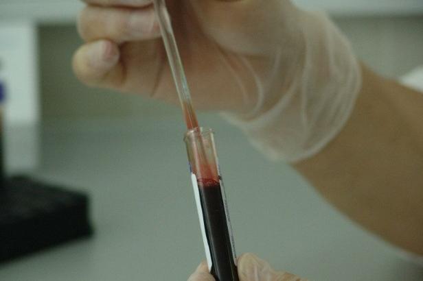PCR тест, платен от граждани, не е условие за прием в болница