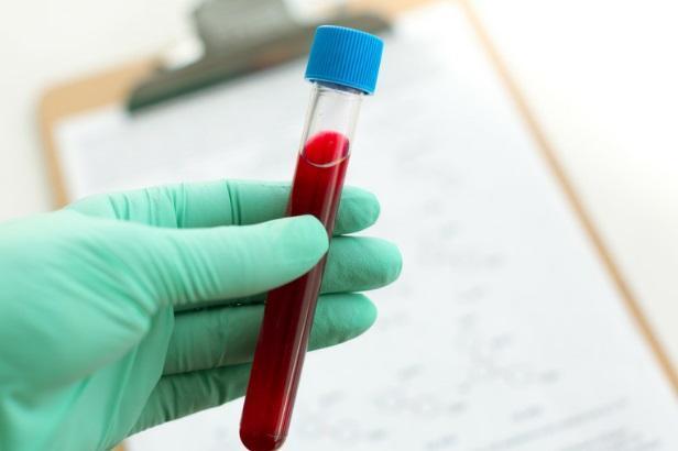 Ново предложение: Направление за PCR тест при наличие на определени симптом
