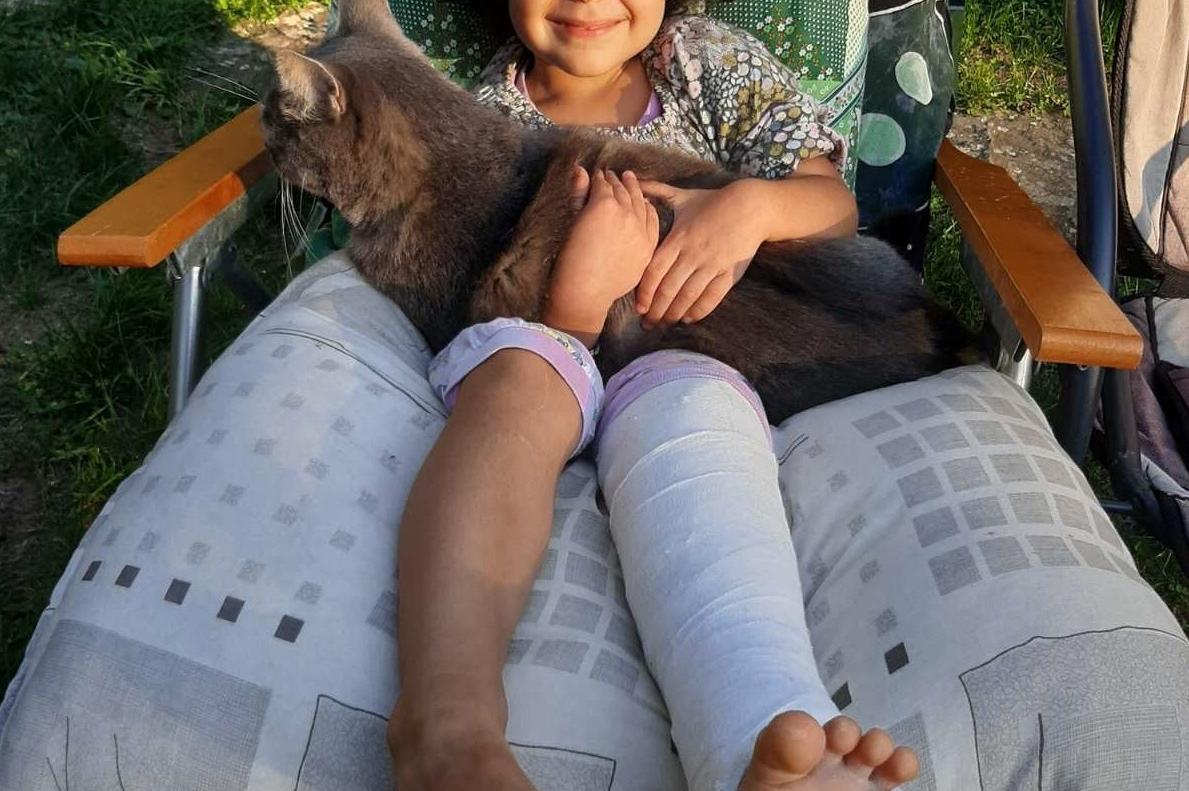 Заради липса на ограда в Княжево: Момиченце е със счупено краче на детска п