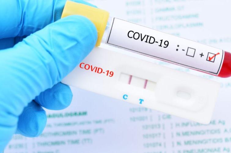 258 са новите случаи на COVID-19 в София