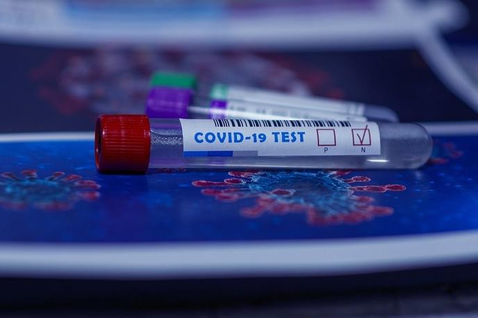 221 са новите случаи на коронавирус в София