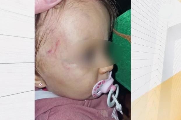 1-годишно дете попадна в „Пирогов“ след падане в столична забавачка